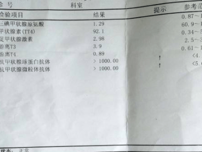 总t4甲状腺球卵白
抗体高（总t4甲状腺球卵白
抗体高怎么办）「甲状腺球蛋白抗体高,t3t4正常」