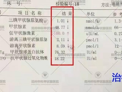 甲功五项t4高会发生什么（甲功五项t4和ft4偏低的缘故起因

）「甲功五项t4和ft4偏低的原因」