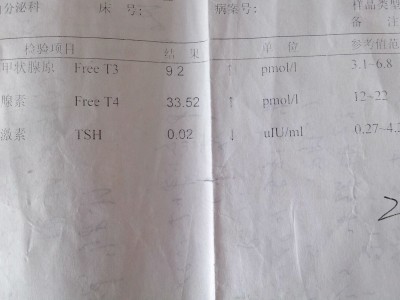 甲亢t4增高（t4增高型甲亢）「甲亢t4很高」